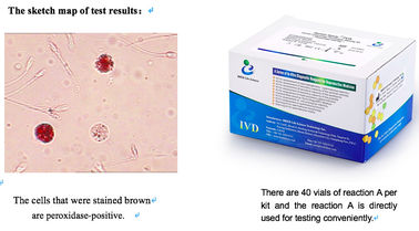 ชุดทดสอบเม็ดเลือดขาวตัวอย่างน้ำเชื้อ 40T/ชุด สำหรับการคัดกรองการติดเชื้อในระบบสืบพันธุ์เพศชาย