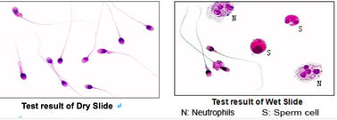 การทดสอบทางสัณฐานวิทยาของเซลล์เม็ดเลือด Pre Stained Slides
