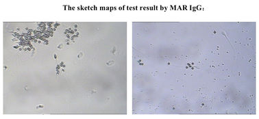 ชุดทดสอบความสามารถในการสืบพันธุ์เพศชายของ SpermFunc สำหรับการตรวจหา IgG Antibody Coating Spermatozoa