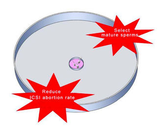 การคัดเลือกตัวอสุจิของกรดไฮยาลูโรนิกสำหรับ ICSI IVF ช่วยลดอัตราการตั้งครรภ์