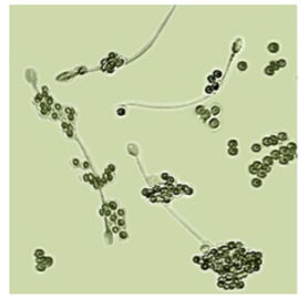 ชุดทดสอบความอุดมสมบูรณ์ของเพศชาย BRED-011 สำหรับการวินิจฉัย Spermatozoa การวินิจฉัยภาวะมีบุตรยากของชาย